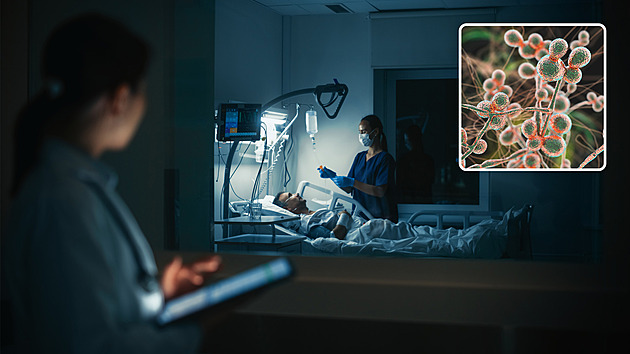 Kvasinkové infekce ohrožují pacienty. Antibiotikům odolávají, jsou i smrtelné